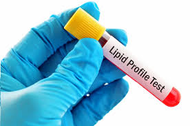 50% Off on Complete lipid profile with 20 test