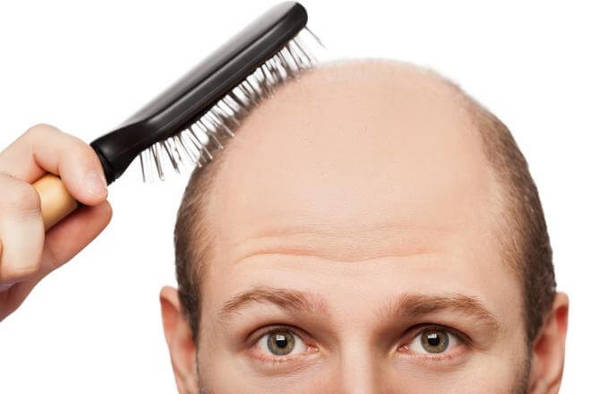 Complete Homeopathic solution for Hair Fall/prevention greying