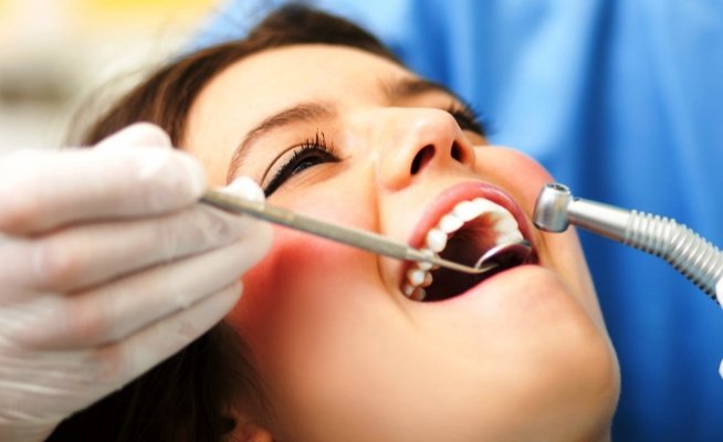 Free Dental Checkup and Consultation