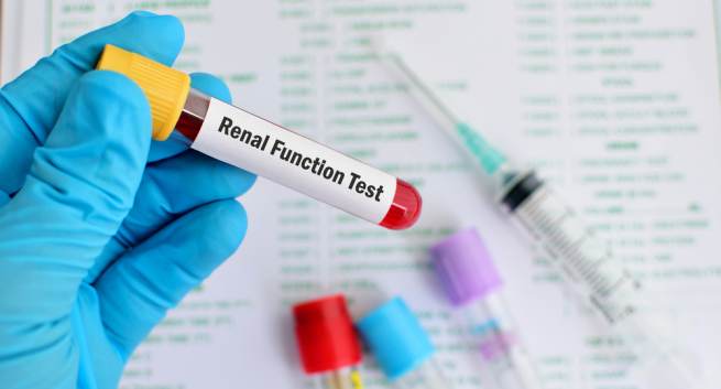ADVANCED RENAL PROFILE ( 9 Test )