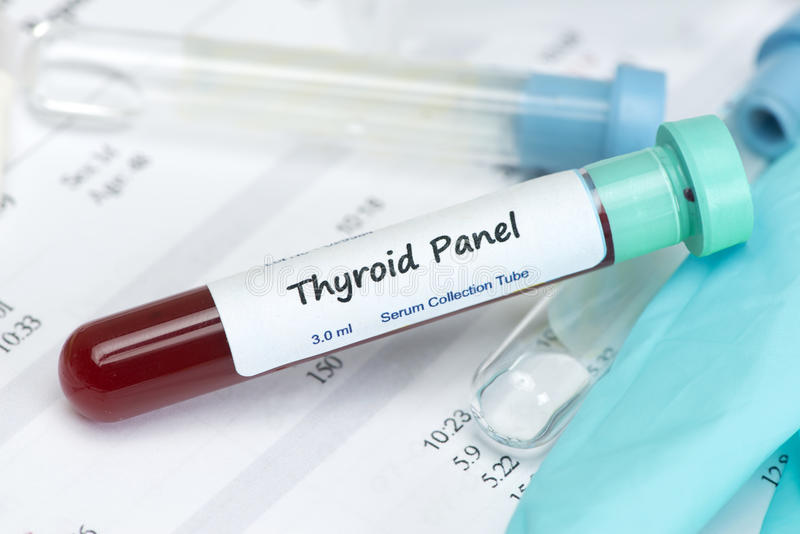 THYROID PANEL 2 (3 Tests)