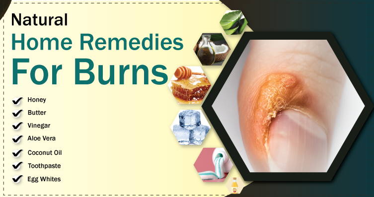 Best Home Remedies For Burns 