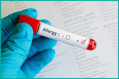 Allergy Blood LabTest
