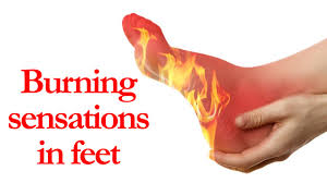 Burning Sensations in Feet