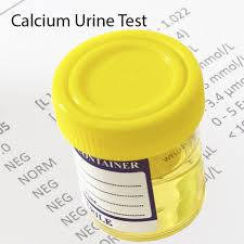 Calcium in Urine LabTest