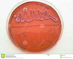Bacteria Culture LabTest