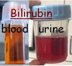 Bilirubin Blood LabTest