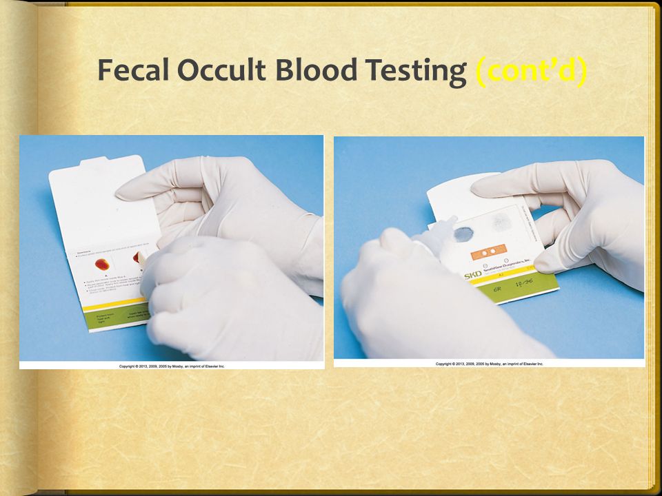 Fecal Occult Blood Labtest Causes Symptoms And Treatment A Total