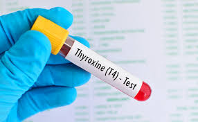 Thyroxine T4 LabTest