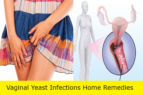 cure yeast infection in women