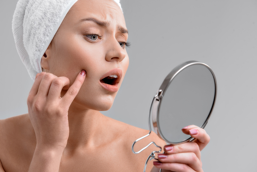 will vanish your acne marks