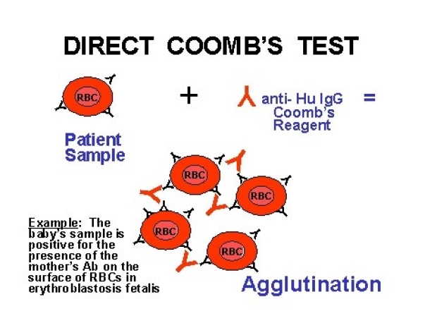 COOMBS TEST DIRECT LabTest