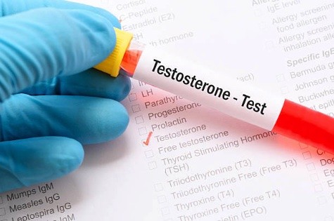 FREE TESTOSTERONE LabTest