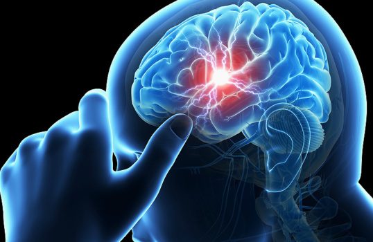 Neurological and Brain