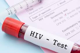 HIV Labtest