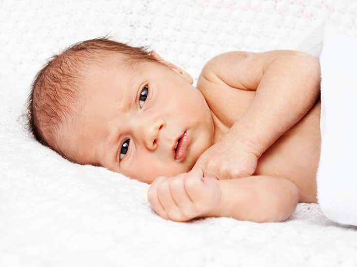 Infant jaundice