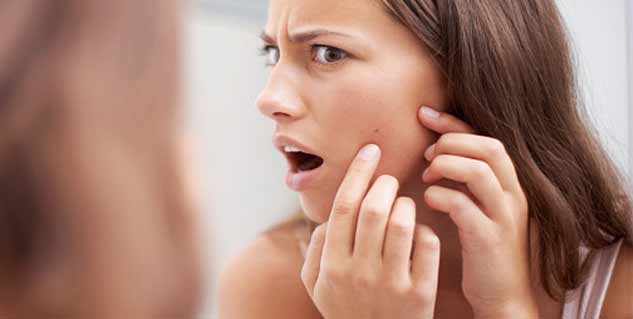 Ayurvedic Care for Acne