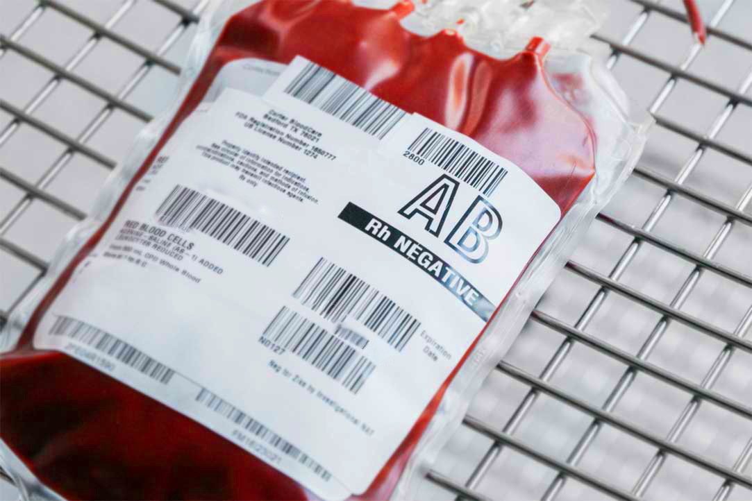AB Negative Blood Type Facts