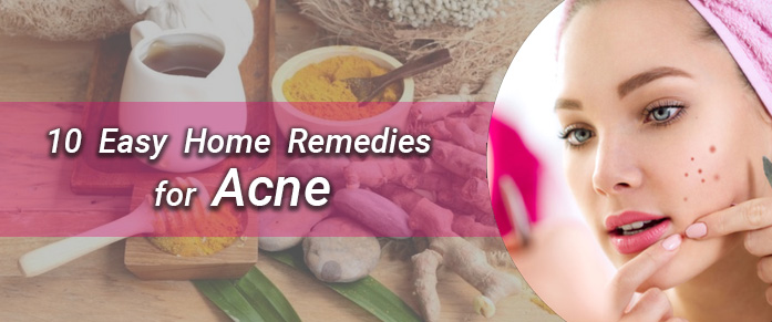 10 Easy Home Remedies for Acne | health news | Kayawell