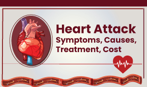 A Complete Heart Attack Guide 2022: Heart Attack Symptoms, Causes, Treatment, Cost