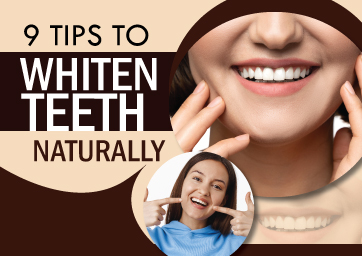 9 Tips to Whiten Teeth Naturally