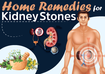 Ayurvedic Home Remedies for Kidney Stones