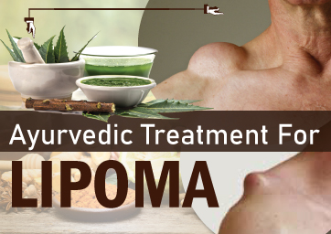 Ayurvedic Treatment For Lipoma