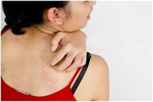 Itching Causes and Symptoms