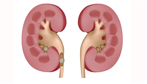 Ayurvedic Home Remedies for Kidney Stones