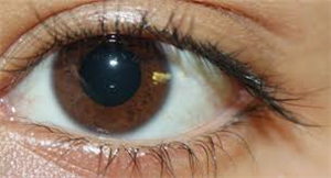 Improve your eyesight with ayurveda