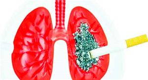 सिगरेट पीने वाले कैसे घटायें फेफड़़ों के कैंसर का खतरा