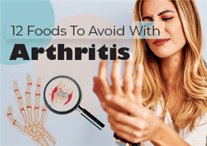 12 Foods To Avoid With Arthritis