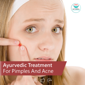 Ayurvedic Treatment for Acne and Pimples
