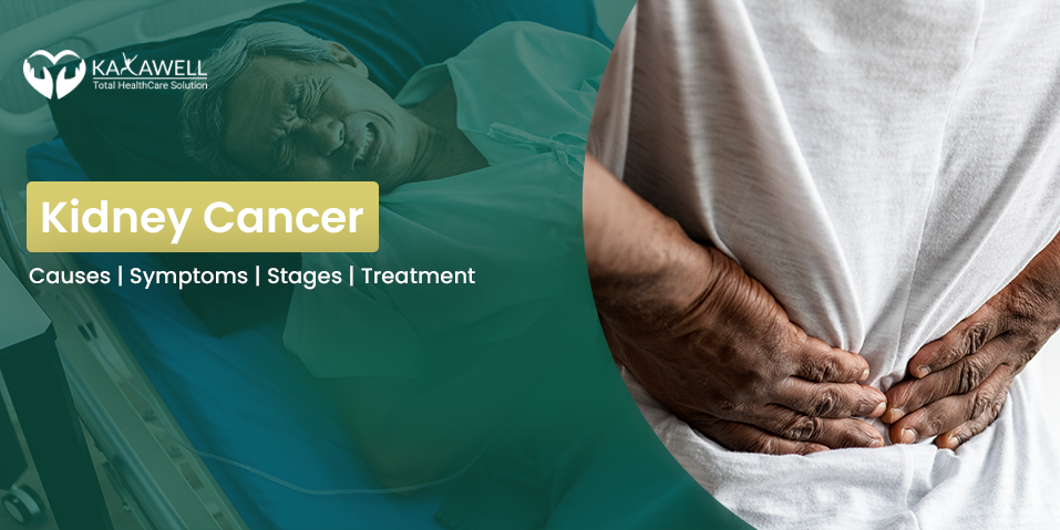 Kidney Cancer: Causes | Symptoms | Stages | Treatment