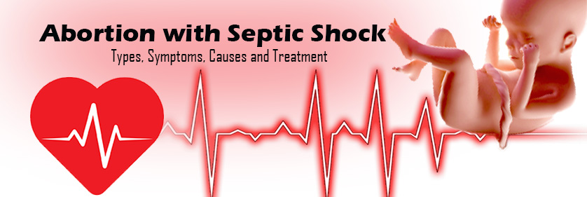 Abortion-with-Septic-Shock2