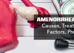 Amenorrhea- Symptoms, Causes, Treatment and Prevention