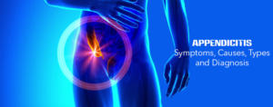 Appendicitis- Symptoms, Causes, Types and Diagnosis