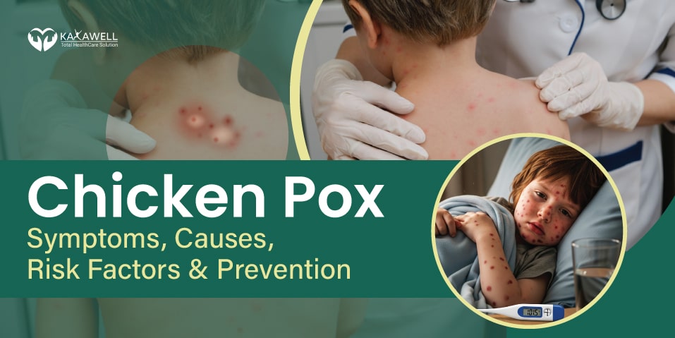 Chicken Pox- Symptoms, Causes, Risk Factors, And Prevention