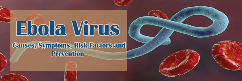 Ebola-Virus2