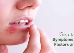 Genital Herpes- Symptoms, Causes, Risk Factors and Prevention
