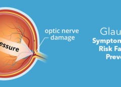 Glaucoma- Symptoms, Causes, Risk Factor and Prevention