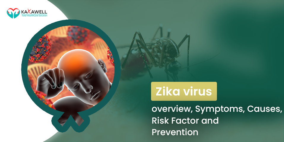 Zika virus