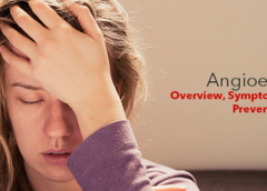 Angioedema- Overview, Symptoms, Causes and Prevention