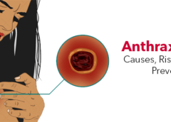 Anthrax- Symptoms, Causes, Risk Factor and Prevention