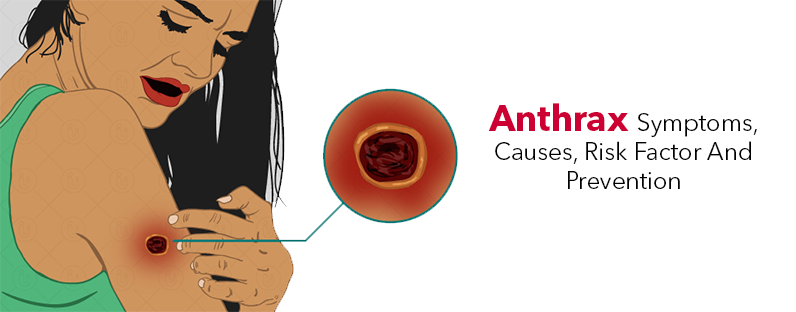 Anthrax- Symptoms, Causes, Risk Factor And Prevention