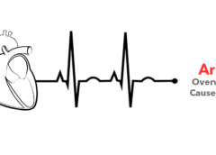Arrhythmia- Overview, Symptoms, Causes and Prevention