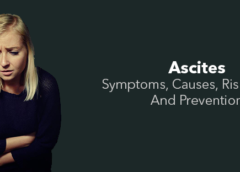 Ascites- Symptoms, Causes, Risk Factors and Prevention