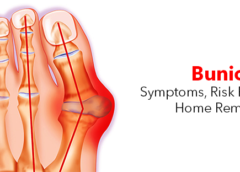 Bunion- Symptoms, Risk Factors and Home Remedies