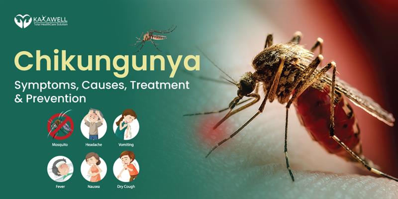 Chikungunya- Symptoms, Causes, Treatment and Prevention