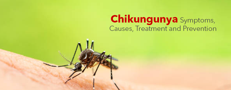 Chikungunya- Symptoms, Causes, Treatment And Prevention, Kayawell health Tips